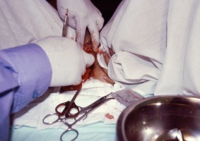 Himenoplastia (2004)